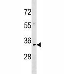 NKX2.6 antibody western blot analysis in CEM lysate