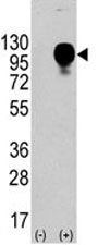 Western blot analysis of CD107b antibody and 293 cell lysate nontransfected or transfected. The protein can be extensively glycosylated and visualized from 45~110 kDa.