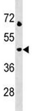 LAMP3 antibody western blot analysis in Jurkat lysate.  Predicted molecular weight: ~44 kDa.