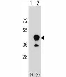 Western blot analysis of CD1b antibody and 293 cell lysate (2 ug/lane) either nontransfected (Lane 1) or transiently transfected (2) with the CD1B gene.