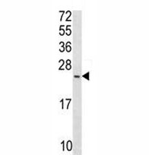 Anti-Bax antibody western blot analysis in T47D lysate