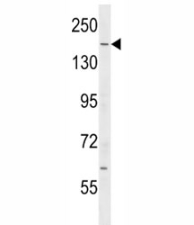 IQGAP2 antibody western blot analysis in mouse testis tissue lysate. Predicted molecular weight ~181 kDa.