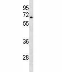 HAS3 antibody western blot analysis in A549 lysate. Predicted molecular weight ~ 63 kDa.