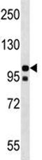 NLRP4 antibody western blot analysis in uterus tissue lysate.
