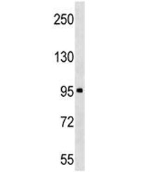 ABI3BP antibody western blot analysis in human K562 lysate. Predicted molecular weight ~118 kDa.