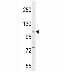 NFKB1 antibody western blot analysis in MDA-MB231 lysate. Expected molecular weight: 105 kDa.