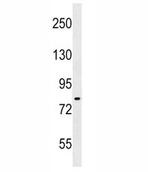 IKK antibody western blot analysis in A549 lysate. Predicted molecular weight ~85 kDa.