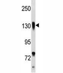 Integrin beta 1 antibody western blot analysis in NCI-H292 lysate. Predicted molecular weight: 88/130~150 kDa (unmodified/glycosylated).