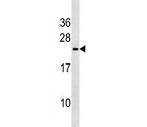 Trem2 antibody western blot analysis in mouse heart tissue lysate. Predicted molecular weight ~25 kDa.