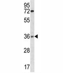 XRCC2 antibody western blot analysis in ZR-75-1 lysate