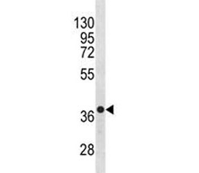 Anti-CXCR4 antibody western blot analysis in NCI-H460 lysate. Predicted molecular weight ~40 kDa but may be observed at higher molecular weights due to glycosylation.