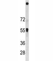 SQSTM1 antibody western blot analysis in HeLa lysate. Observed molecular weight ~62 kDa.