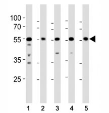 Western blot analysis of lysate from (1) A431, (2) RD, (3) mouse NIH3T3, (4) mouse C2C12, and (5) rat PC-12 cell line using Src antibody at 1:1000.