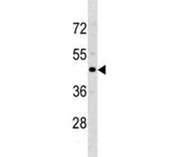 CCR5 antibody western blot analysis with human MDA-MB231 lysate. Predicted molecular weight ~41 kDa.