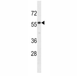 IL17RE antibody western blot analysis in HepG2 lysate.