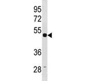 TUBG1 antibody western blot analysis with human HepG2 lysate. Predicted molecular weight ~51 kDa.