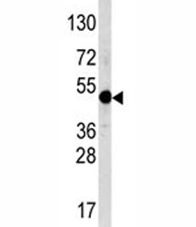 Western blot analysis of AP2 antibody and NCI-H460 lysate. Predicted molecular weight ~47 kDa.