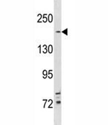 TSC2 antibody western blot analysis in NCI-H292 lysate. Predicted molecular weight ~200 kDa.