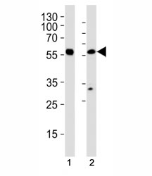 Western blot analysis of (1) HL-60 and (2) U251 MG cell line using p65 antibody at 1:1000.