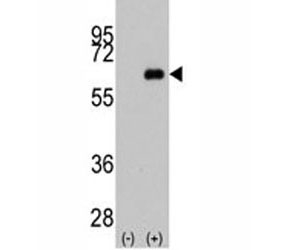 Western blot analysis of anti-c-Myc antibody and 293 cell lysate (2 ug/lane) either nontransfected (Lane 1) or transiently transfected with the MYC gene (2).