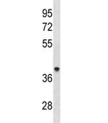 ACAA1 antibody western blot analysis in human 293 lysate. Predicted molecular weight ~44 kDa.