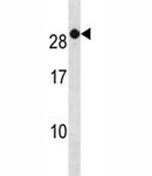 RAB7B antibody western blot analysis in A2058 lysate. Predicted molecular weight ~23 kDa.