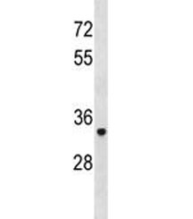 TRAP antibody western blot analysis in human A2058 lysate. Predicted molecular weight ~36 kDa.