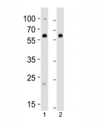 Western blot analysis of lysate from 1) human 293 and 2) mouse NIH3T3 cell line using BMPR1A antibody at 1:1000. Predicted molecular weight ~60 kDa.