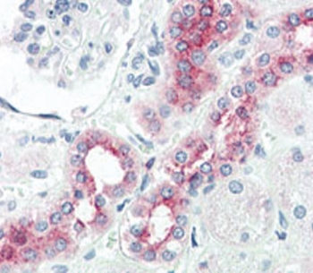 IHC analysis of FFPE human kidney tissue stained with BMPR2 antibody.