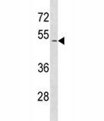 SMAD1 antibody western blot analysis in HeLa lysate. Predicted molecular weight: 52~60 kDa.