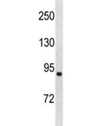 ACSL1 antibody western blot analysis in human NCI-H292 lysate. Predicted molecular weight ~78 kDa.