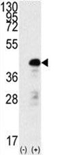 Western blot analysis of SOX2 antibody and 293 cell lysate (2 ug/lane) either nontransfected (Lane 1) or transiently transfected with the SOX2 gene (2).