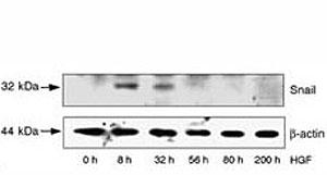 HepG2 cells were incubated with HGF for the indicated time periods. LiCl and MG132 were added 8 hr before lysis of the cells. SNAIL protein and beta actin (loading control) levels were analyzed by western blot.