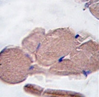 IHC analysis of FFPE human skeletal muscle tissue stained with Myostatin antibody