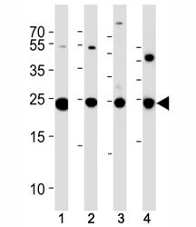 PGP 9.5 antibody western blot analysis in (1) U266, (2) NCI-H1299, (3) mouse Neuro-2a cell line and (4) mouse brain tissue lysate. Predicted molecular weight ~25 kDa.