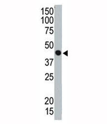 Western blot testing of TSG101 antibody and ZR75-1 cell lysate. Predicted molecular weight ~45 kDa.