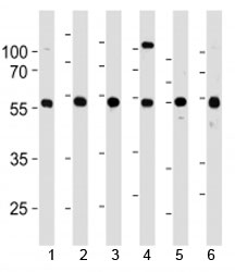 YY1 antibody western blot analysis in 1) 293, 2) HL-60, 3) SiHa, 4) K562, 5) THP-1 and 6) U266 lysate. Predicted molecular weight ~45 kDa, observed molecular weight 45~65 kDa.