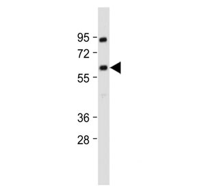 Western blot testing of human MOLT4 cell lysate with YY1 antibody. Predicted molecular weight ~45 kDa but commonly observed at 45~65 kDa.