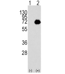 Western blot analysis of ACOX1 antibody and 293 cell lysate either nontransfected (Lane 1) or transiently transfected with the ACOX1 gene (2). Predicted molecular weight ~74 kDa.