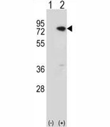 Western blot analysis of MeCP2 antibody and 293 cell lysate (2 ug/lane) either nontransfected (Lane 1) or transiently transfected (2) with the MeCP2 gene. Observed molecular weight: ~55 kDa and ~75 kDa.