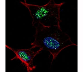 Fluorescent confocal image of SY5Y cells stained with KLF4 antibody at 1:100. Note the highly specific localization of immunoreactivity to the nuclei.