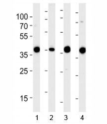 Western blot analysis of lysate from 1) 293, 2) RD, 3) mouse NIH3T3 and 4) rat L6 cell line using Aldolase antibody at 1:1000. Predicted molecular weight ~40 kDa.