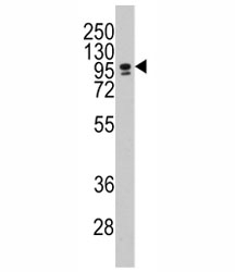 Western blot analysis of CEBPZ / CBF antibody and NCI-H460 lysate. Predicted molecular weight: ~120kDa.