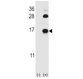 Western blot analysis of FABP4 antibody and 293 cell lysate (2 ug/lane) either nontransfected (Lane 1) or transiently transfected (2) with the FABP4 gene. Predicted molecular weight ~15 kDa.