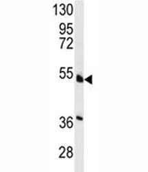 Western blot analysis of HNF4A antibody and NCI-H460 lysate. Predicted molecular weight ~50 kDa.