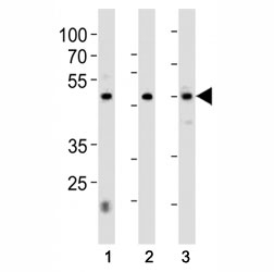 HNF4A antibody western blot analysis in 1) 293, 2) HepG2 cell line and 3) rat liver tissue lysate. Predicted molecular weight ~50 kDa.