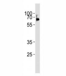 LCK antibody western blot analysis in Ramos lysate. Predicted molecular weight ~58 kDa.