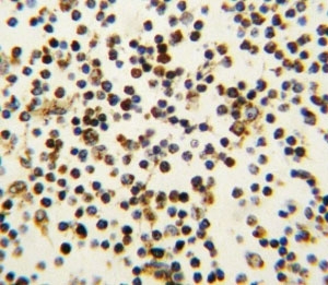 IHC analysis of FFPE human lymph tissue stained with NPM1 antibody