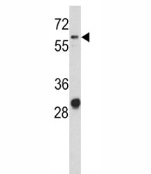 Western blot analysis of CD166 antibody and NCI-H460 lysate. Predicted molecular weight ~65 kDa (unmodified), 100-105 kDa (glycosylated).