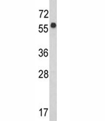 Western blot analysis of WDR1 antibody and CEM lysate. Predicted molecular weight ~66 kDa.